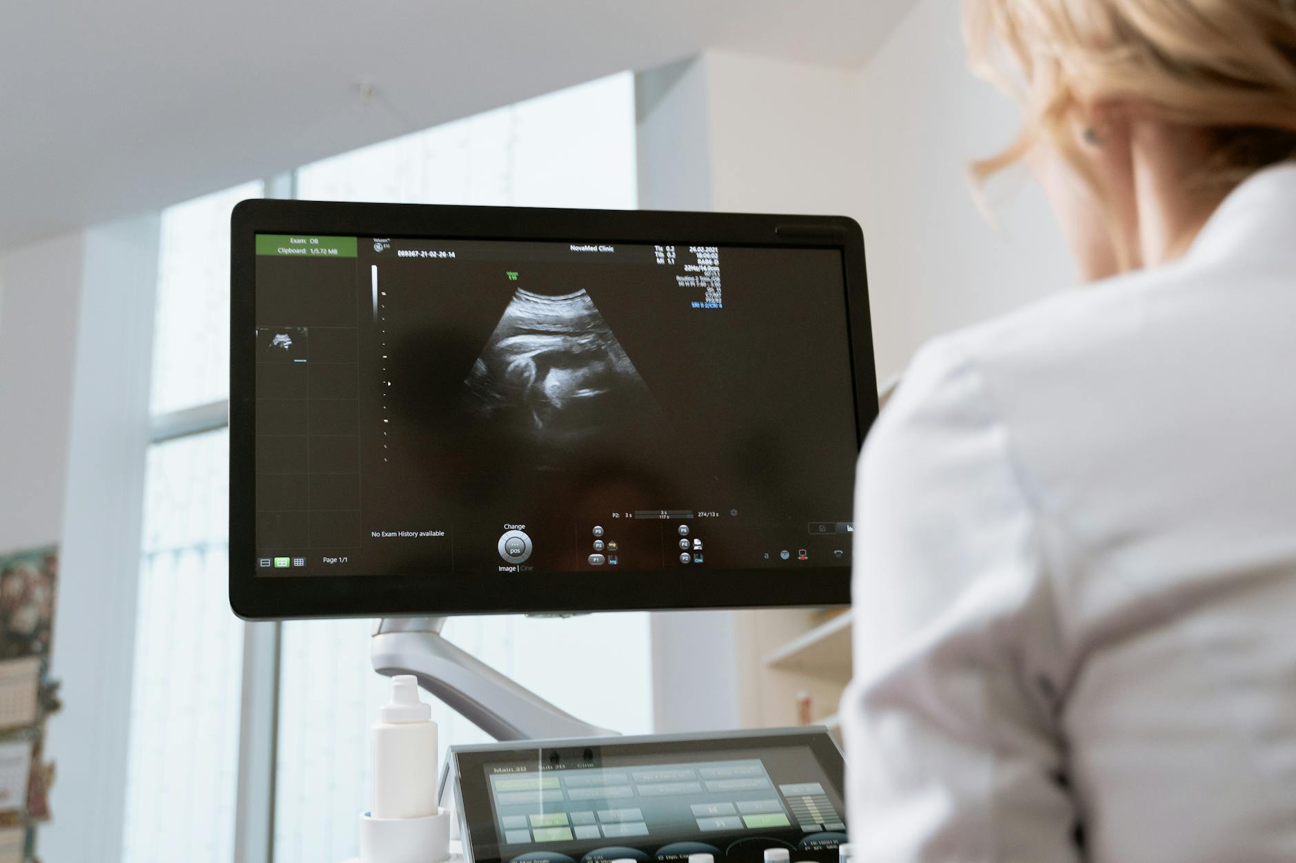 UH Research Breakthrough: In-Utero Therapy May Prevent Spongy Heart Disease Before Birth