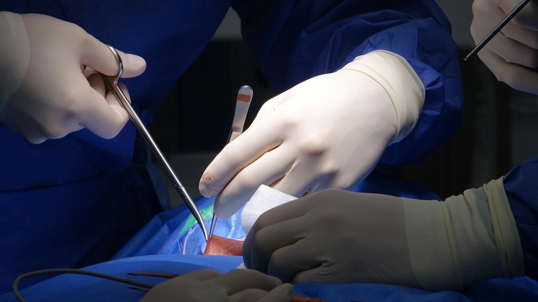 Rising Demand for Pediatric Heart Transplants Collides With Critical Donor Shortage